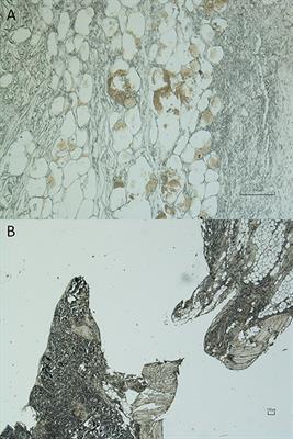 Use of the international classification of diseases (ICD)-11 method applied to veterinary forensic pathology for coding the cause and manner of death in wildlife